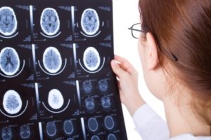 ohio brain injury doctor examines xray